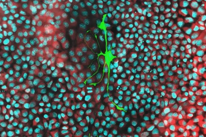 《Science》2025年度“十大科学突破”榜单揭晓(图4)